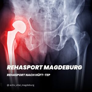 Rehasport nach Hüft-TEP in Magdeburg